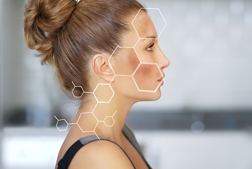 Dark spots, freckles,hyperpigmentation(melasma or chloasma)